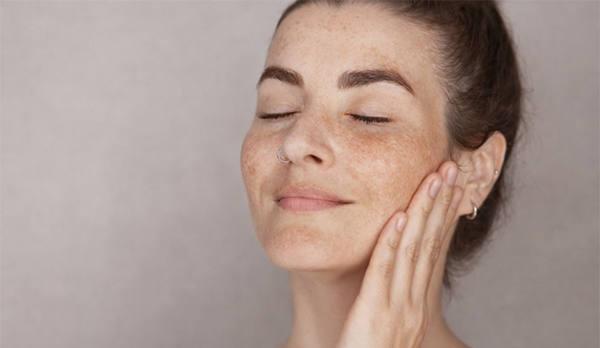 Manchas na pele: laser frio, oxigenação celular e peelings suaves despontam como novas estratégias de tratamento